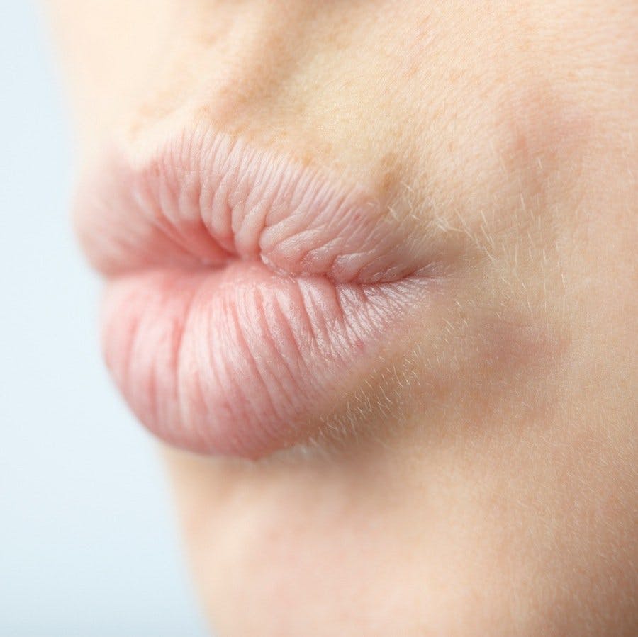 Kan han få herpes dersom jeg utfører oralsex på ham mens jeg har munnsår?